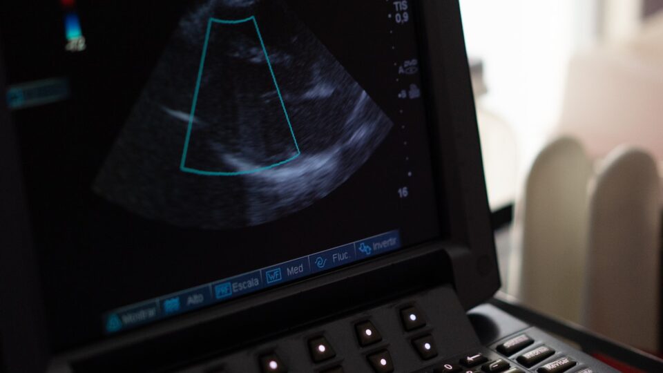 Resumo de ecocardiograma: indicações, técnica e muito mais!